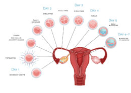 PCOS: Entwicklung von Follikel und Embryo